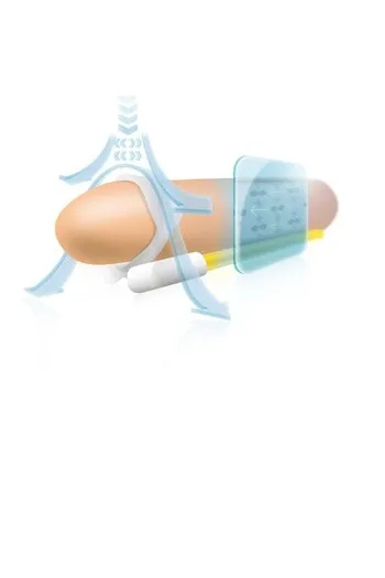 Andropenis Mini | Allungamento Pene Medicale per Dimensioni Inferiori a 8 cm